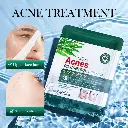 TeaTreeAcneOilControlAnti-AcneFacialSheetMask-2_1200x.webp